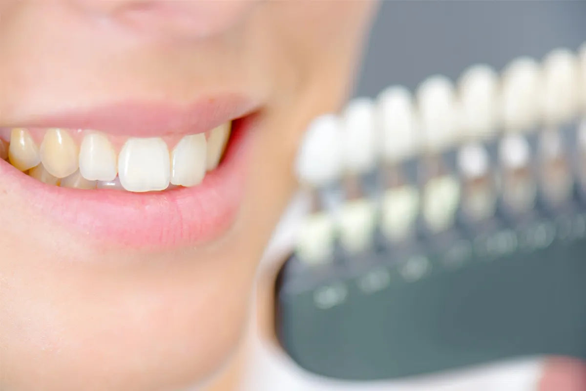 Come rimuovere le macchie ai denti