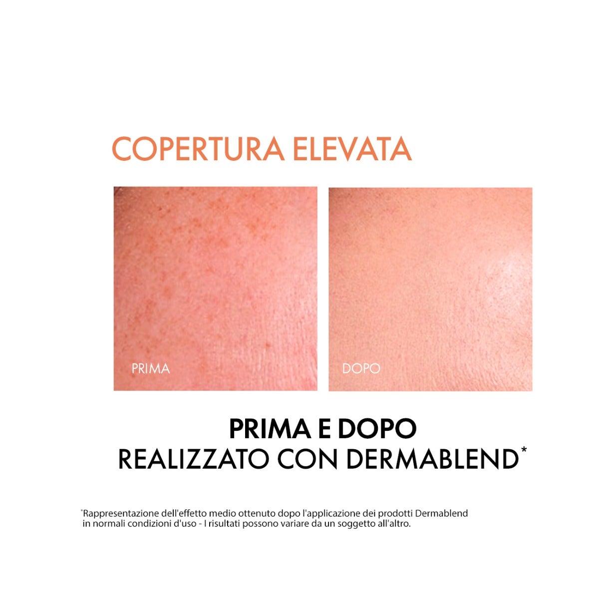 Vichy Dermablend Fondotinta Fluido Coprente Tonalità 55 30ml SPF35-8
