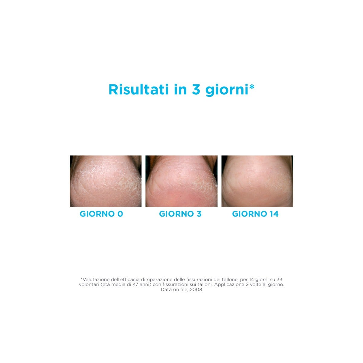 Isdin Ureadin Podos Gel Oil Idratante Per Piedi Secchi 75ml-4