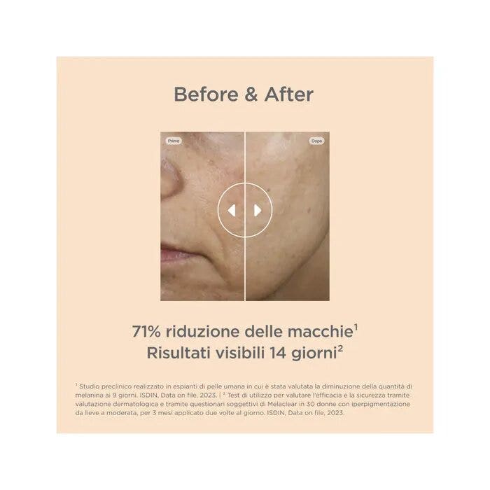 Isdinceutics Melaclear Siero Antimacchie 30ml-11