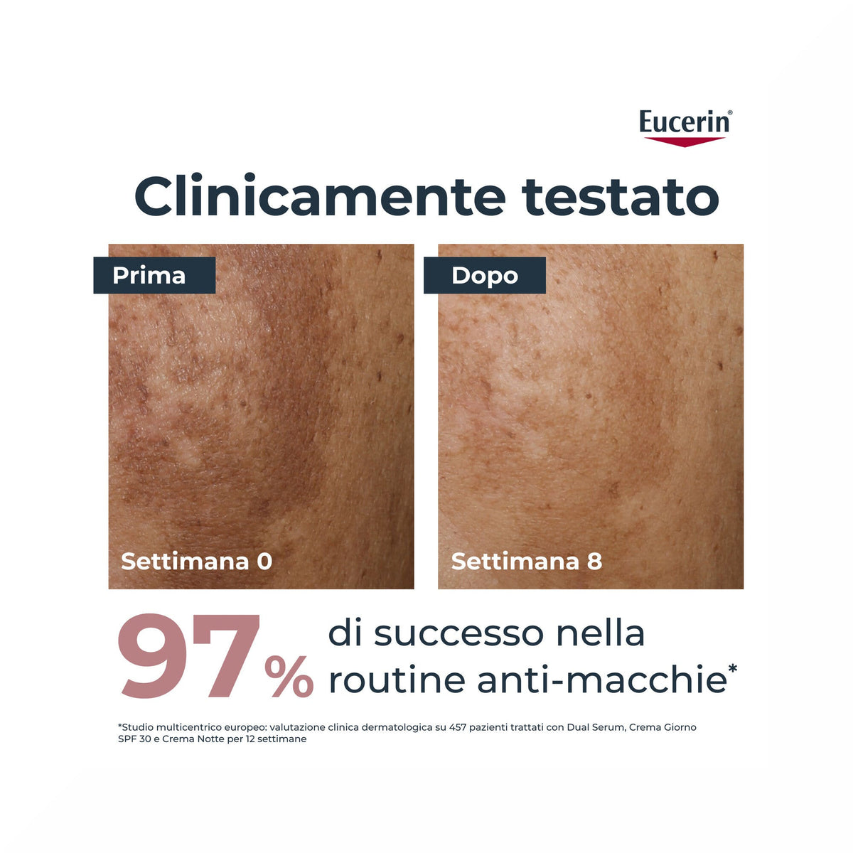 Eucerin Anti-Pigment Giorno SPF30 50ml-3
