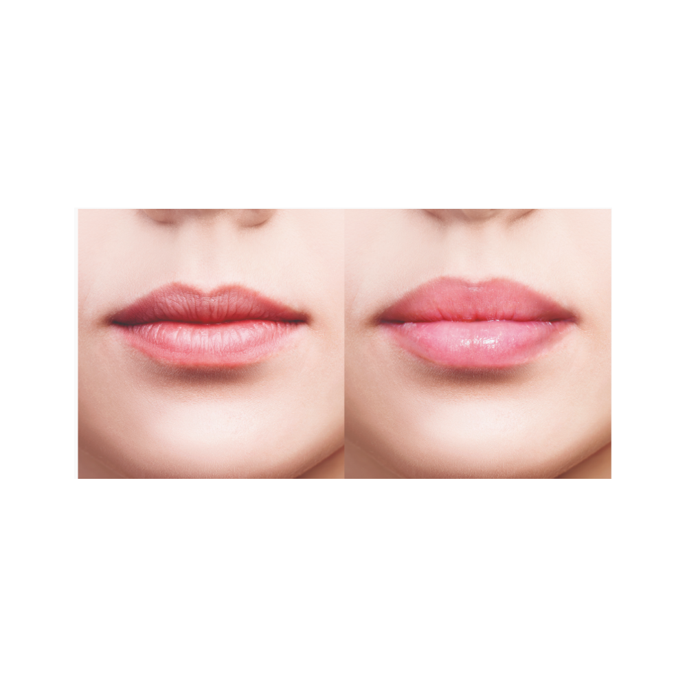 Lovren Superb Lip Plump Active Labbra 1 Pezzo-3